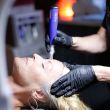 Load image into Gallery viewer, Microneedling & Botox Facials