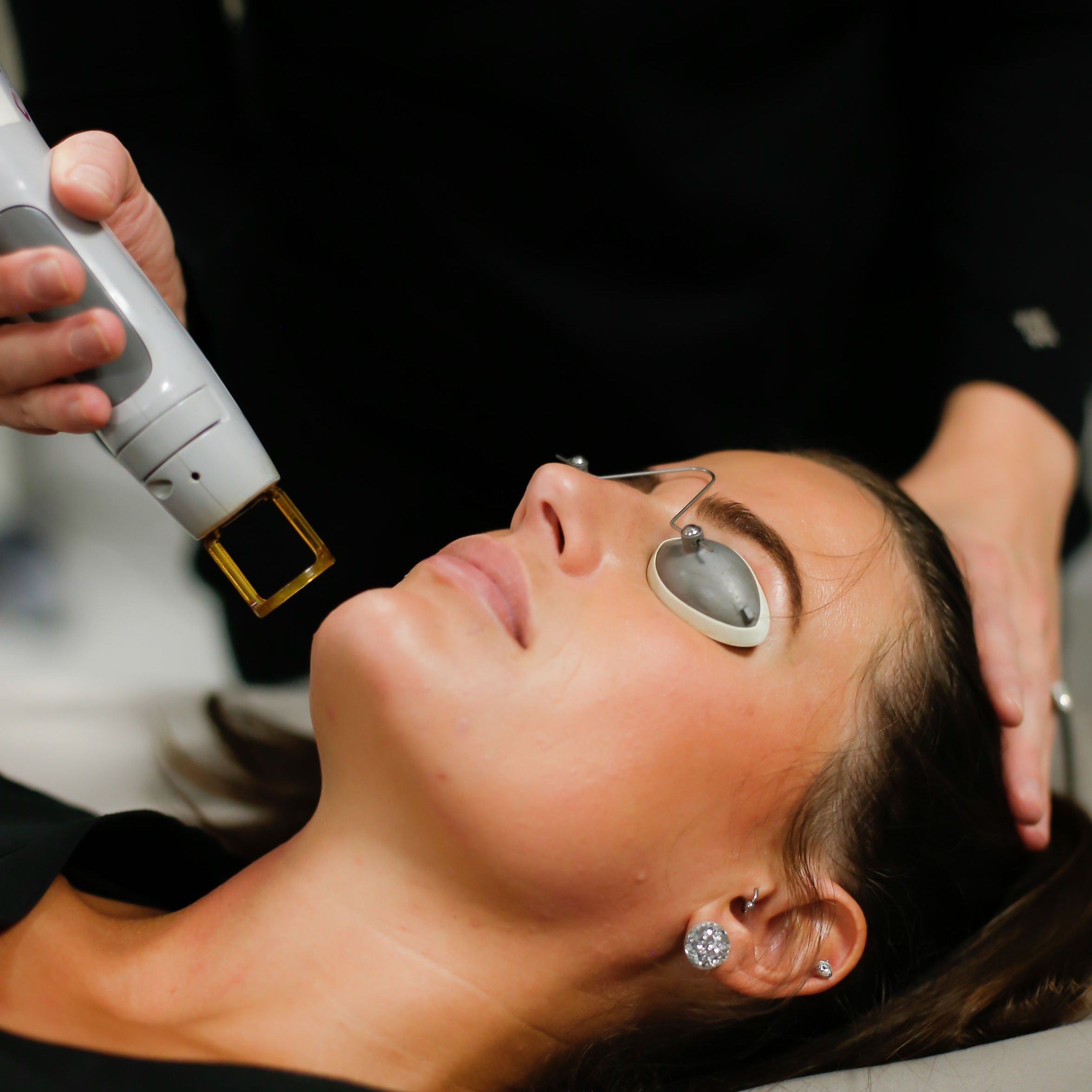 Facial Laser Treatments Emerge South Tulsa